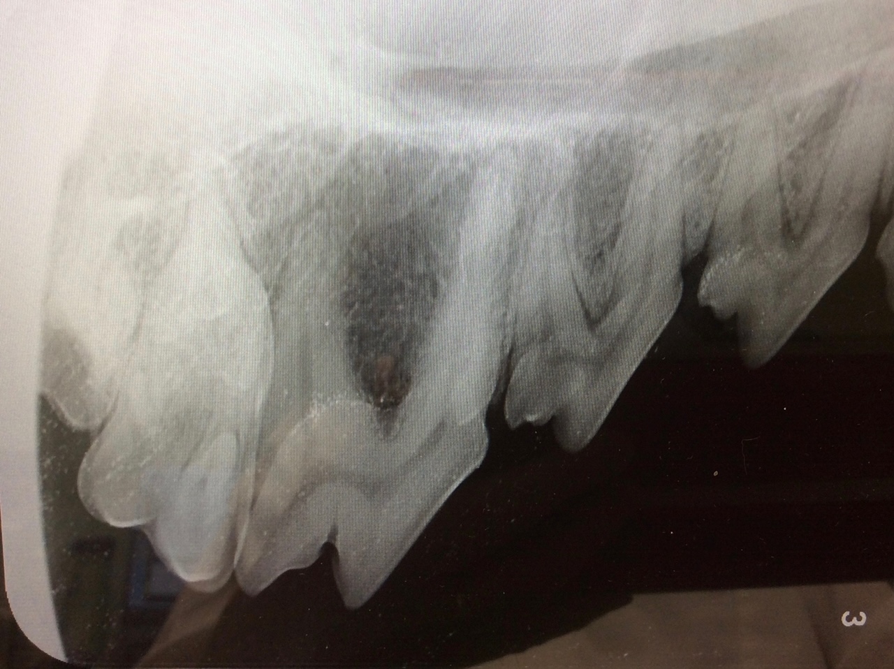 another dental x-ray