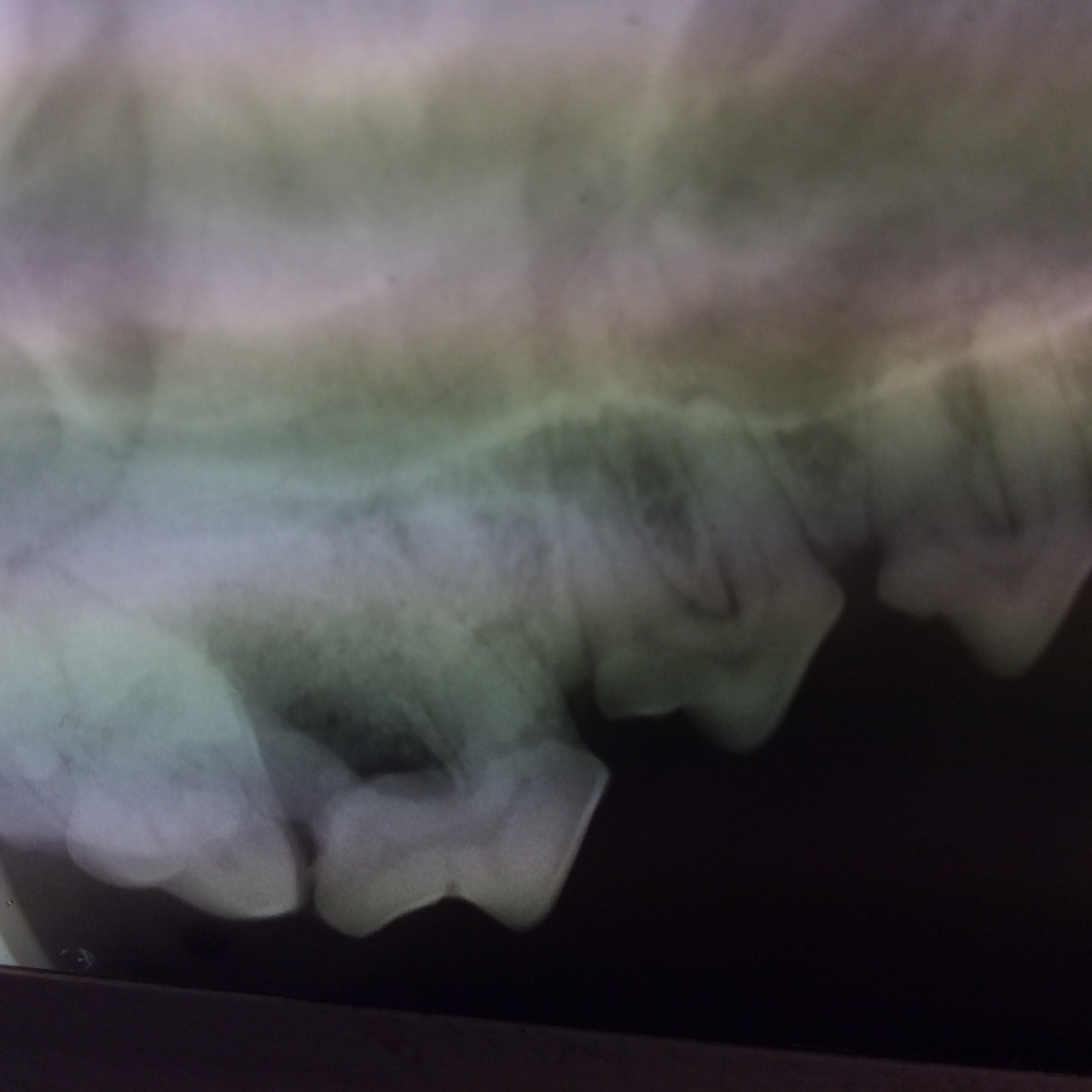 dental x-ray