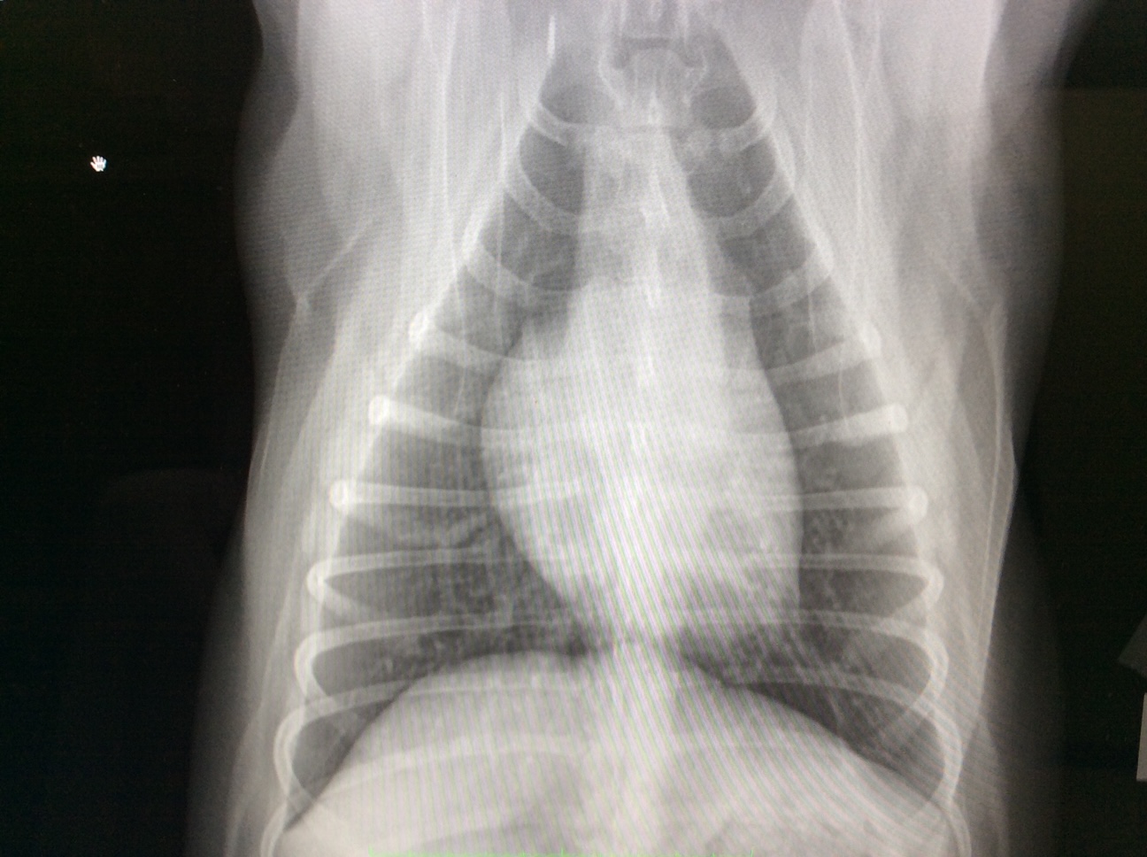 barium radiograph of gastrointestinal system